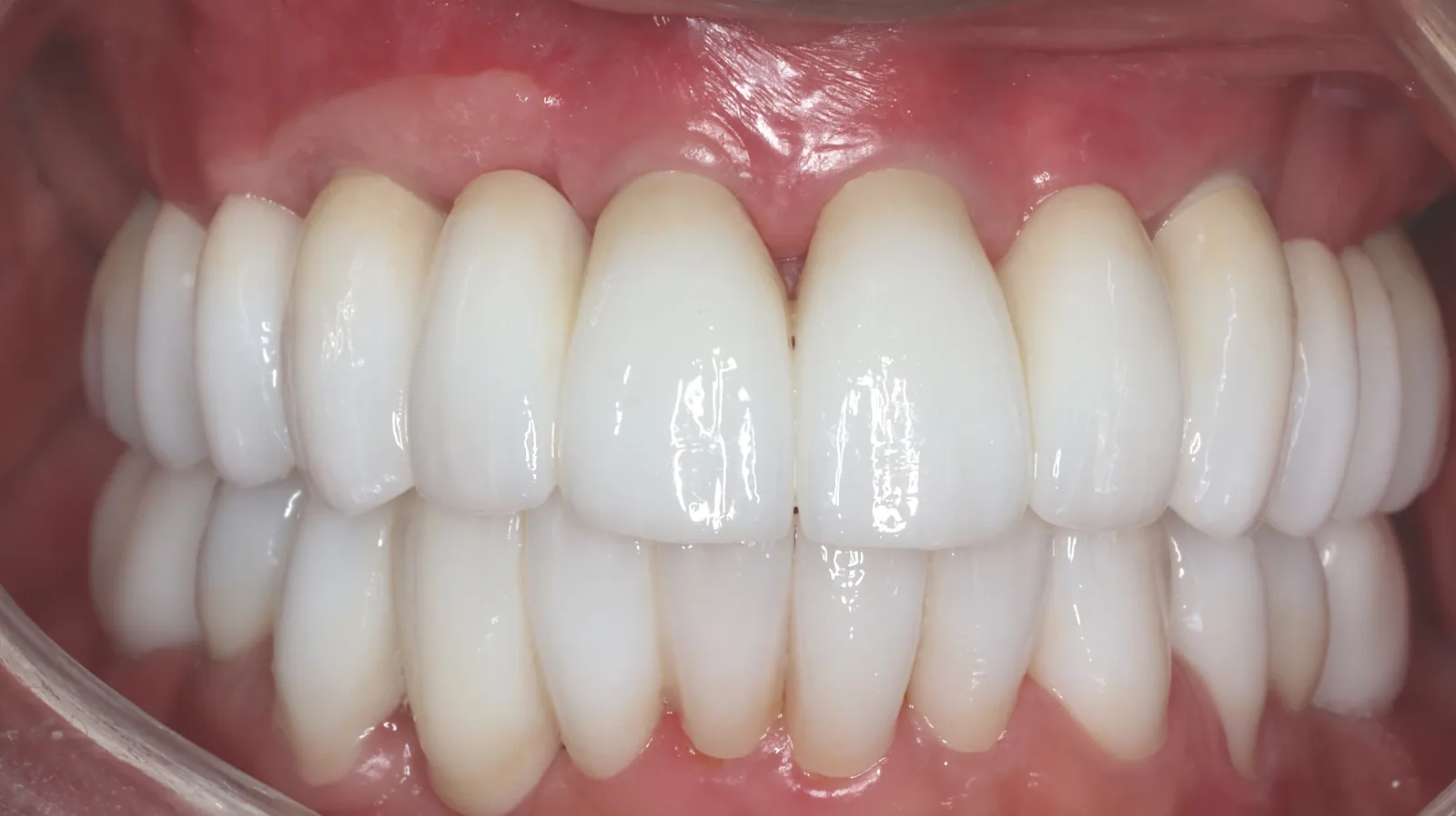 All on 6 Patientenbilder 1 Ergebnis