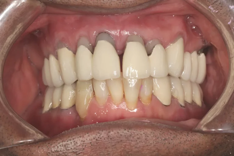 Ausgangssituation frontal
