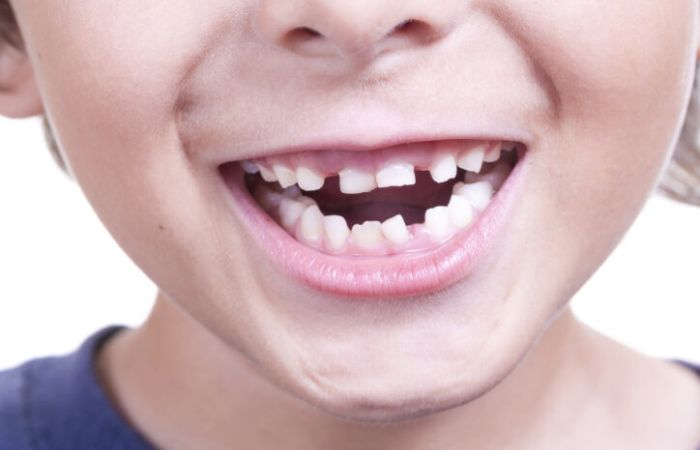 Gesundheitssysteme: Auswirkungen auf Kindermundgesundheit