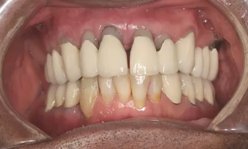 All on 6 Patientenbilder