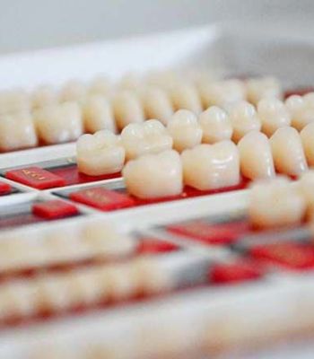 Voraussetzungen für Zahnimplantate