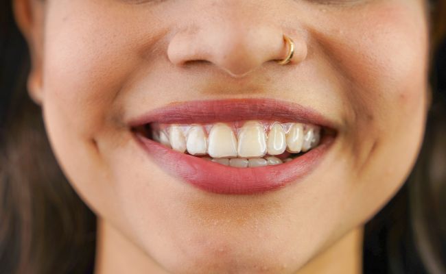 Unsichtbare Zahnspange – Alignertherapie in Berllin